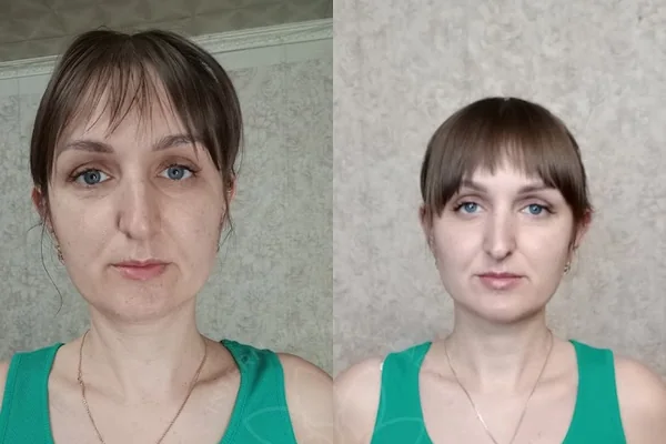 Before and after result 12