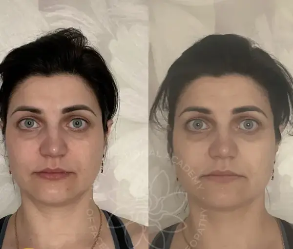 Before and after result 7
