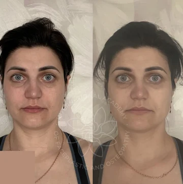 Before and after case 8