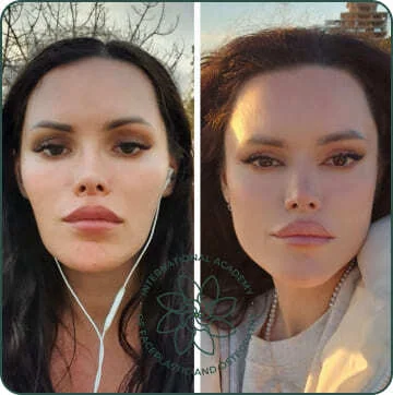 Before and after case 1