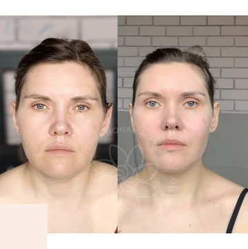 Before and after case 7