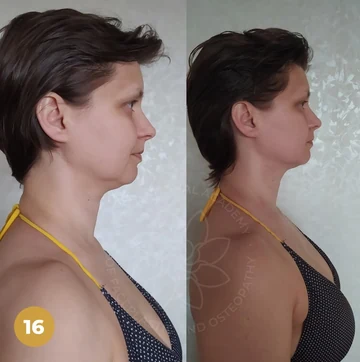 Anti-Swelling Program