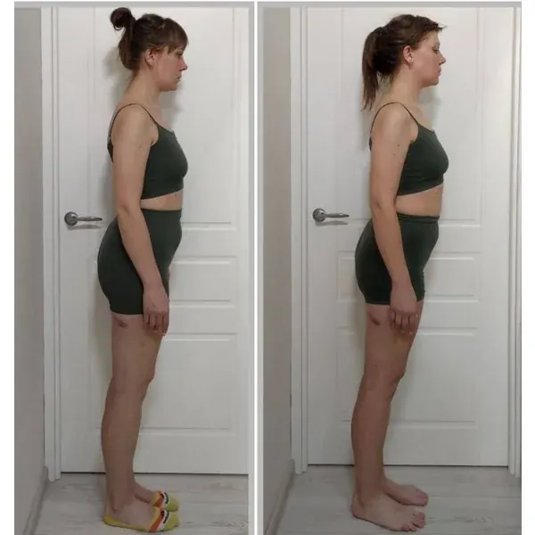 Before and after โ taller posture