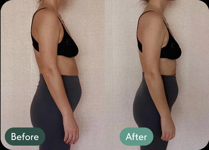Before and after