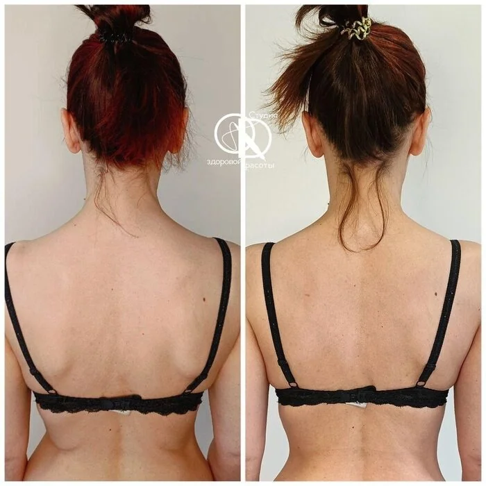 Before and after